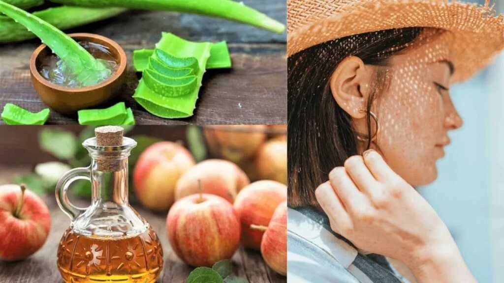 နေလောင်ခြင်းအတွက် အကောင်းဆုံး အိမ်တွင်းကုထုံး ( ၇ ) မျိုး