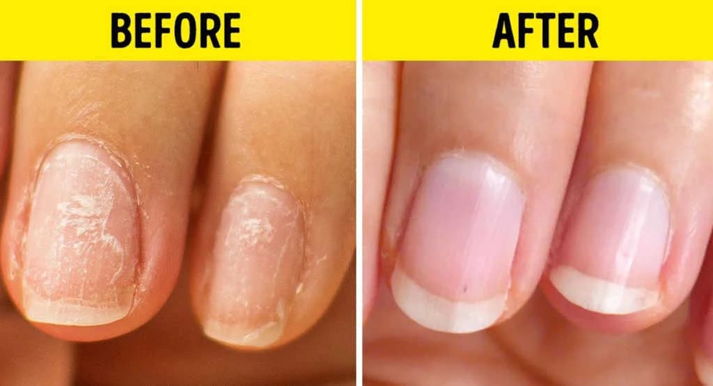 လက်သည်းပျက်စီးနေတဲ့သူတွေအတွက် Healthy Nails လေးကိုရရှိစေမယ့်နည်းလမ်းများ