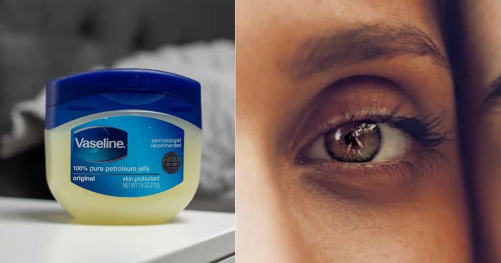 Vaseline ကို သုံးပြီး ၇ ရက်အတွင်း မျက်ကွင်းညိုတာ သက်သာအောင် ပြုလုပ်နည်း