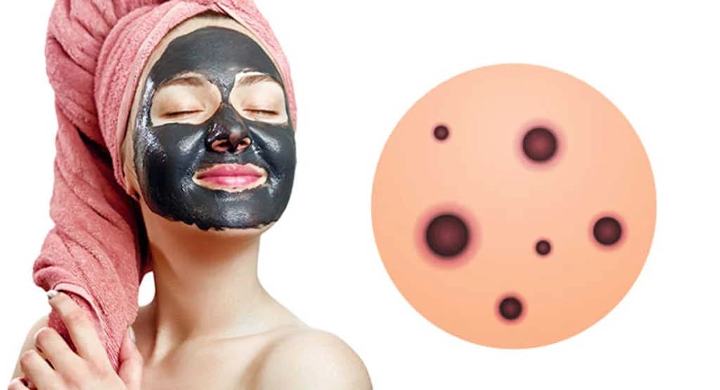 ဆားဝက်ခြံတွေကိုဖယ်ရှားပေးမယ့် Homemade Mask လုပ်နည်း ၅ မျိုး