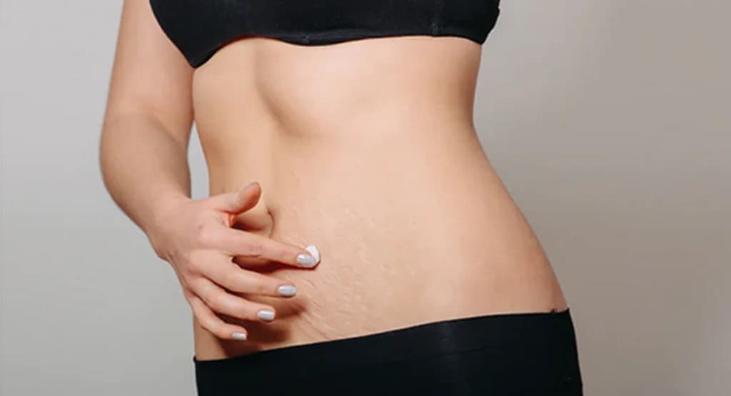 အကြောပြတ်ရာတွေသက်သာစေဖို့နဲ့ မဖြစ်အောင်ကြိုတင်ကာကွယ်နိုင်မယ့် နည်းလမ်း ၃ မျိုး