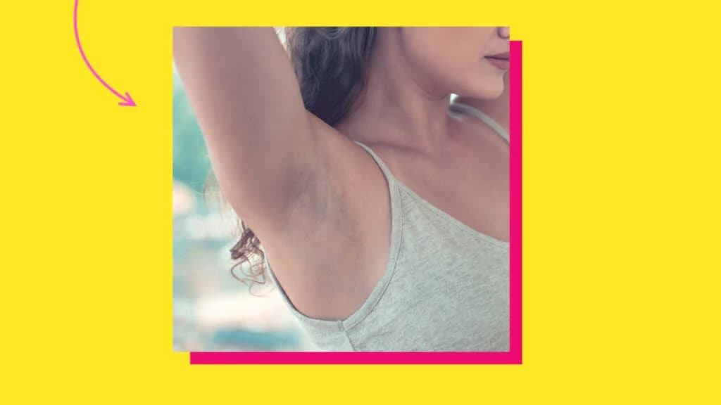 Laser နဲ့ Hair Removal လုပ်မယ်ဆိုရင် သတိထားရမယ့်အချက် ( ၅ ) ချက်