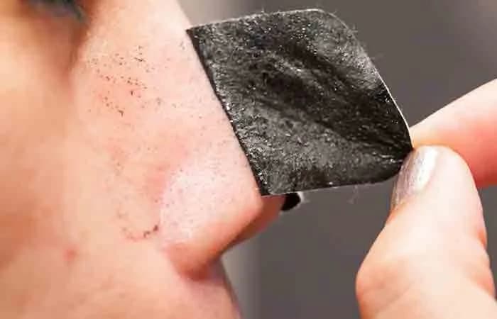 Blackheads တွေကို အိမ်မှာတင်ဖယ်ရှားနိုင်တဲ့ နည်းလမ်း ( ၅ ) ခု