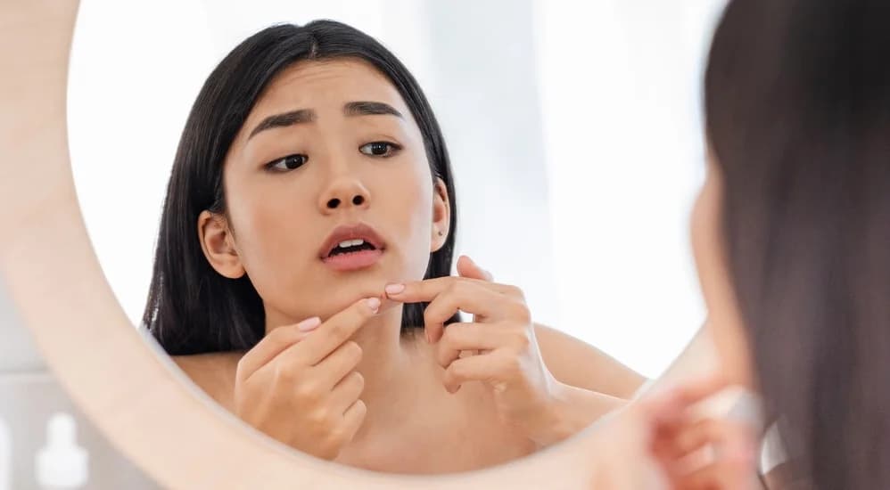 Dermatologists တွေရဲ့အဆိုအရ ဝက်ခြံတွေအမြန်ဆုံးသက်သာစေမယ့်နည်းလမ်းများ