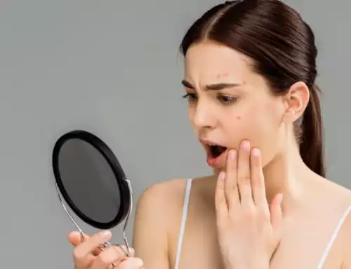 Oily Skin ရှိသူတွေနဲ့မတည့်တဲ့ အိမ်တွင်း အလှအပထိန်းသိမ်းမှုပစ္စည်း (၅) မျိုး