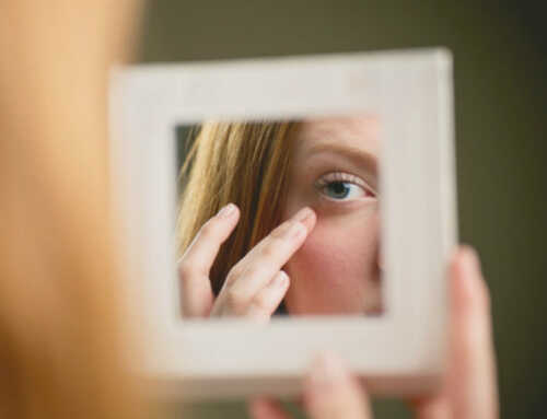 ကိုယ်ဝန်ဆောင်စဉ် မျက်ကွင်းညိုခြင်းကို သက်သာစေမယ့် ကုသနည်း ၃ မျိုး