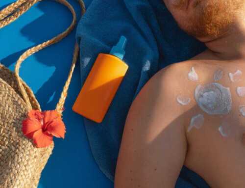 Dermatologists တွေ့ရဲ့အကြံပြုချက်အရ နေလောင်ဒဏ် သက်သာစေမယ့် Lotion ( ၅ ) မျိုး